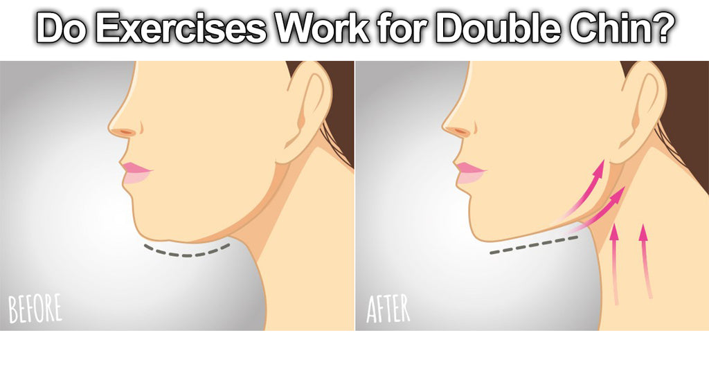 Do Exercises Work for Double Chin?