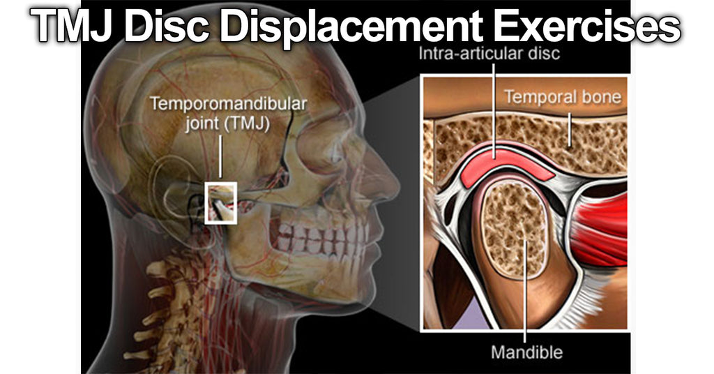 TMJ Disc Displacement Exercises